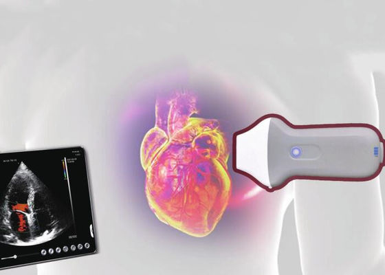 PDI WiFi Kablosuz Taşınabilir Ultrason Tarayıcı 128 Öğe